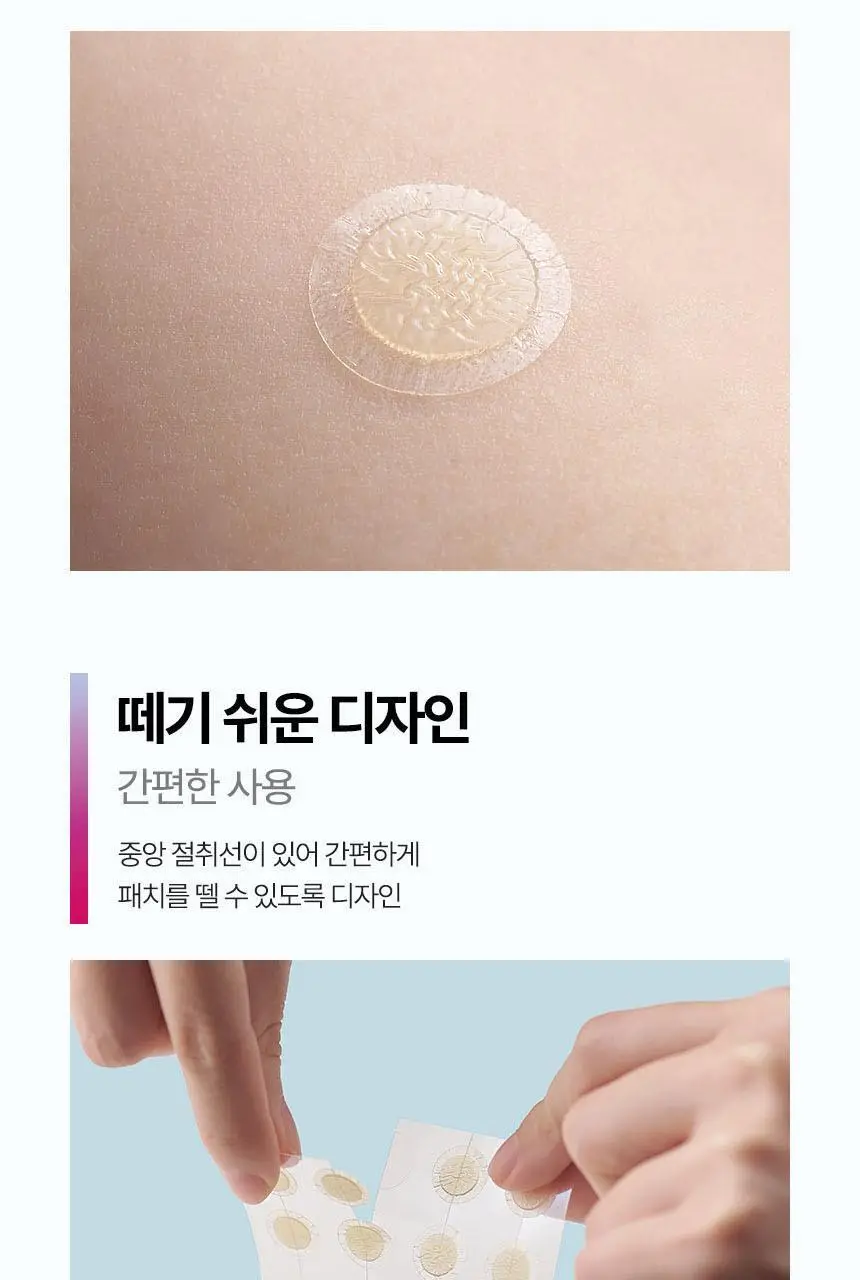 [의료기기] 듀오덤 스팟패치 72매 기획(+ 밴드 3매) 상세페이지 23